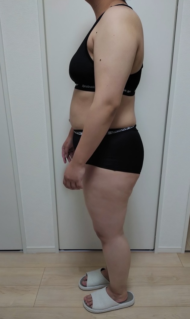 30代の変化・BEFORE
