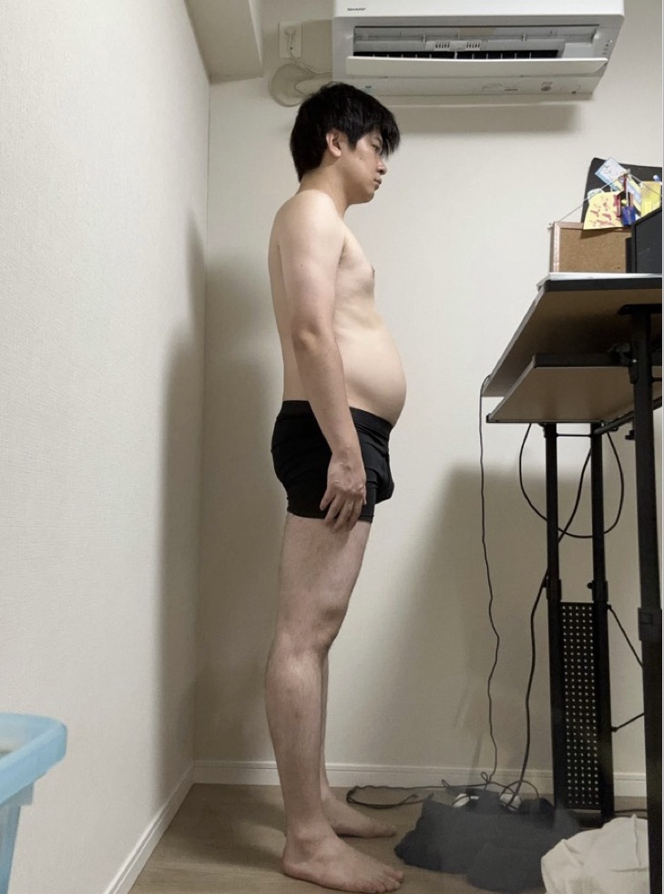 30代・1ヶ月の変化 BEFORE